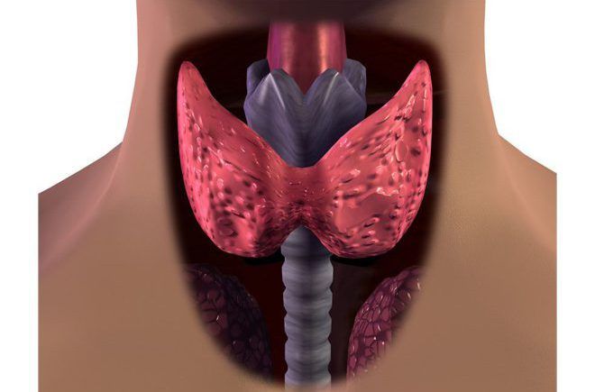 Хронический тиреоидит щитовидной железы