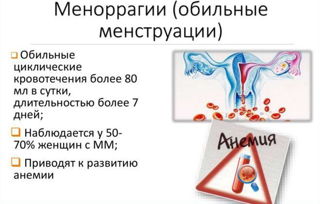 Обильные менструации