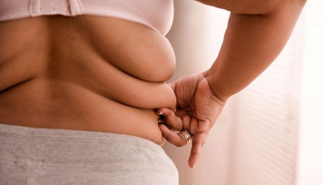 В большинстве случаев миома матки образуется у женщин с ожирением