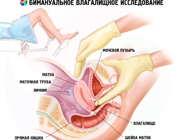 Бимануальное гинекологическое обследование