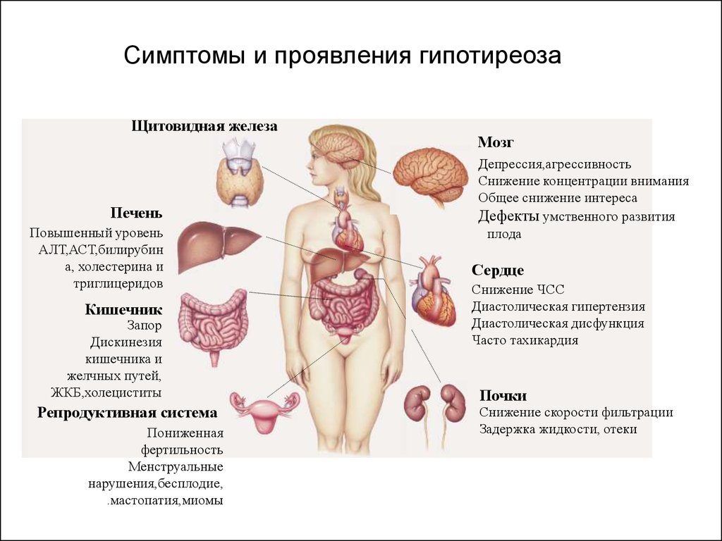 Симптомы гипотиреоза у женщин и лечение щитовидной железы 2