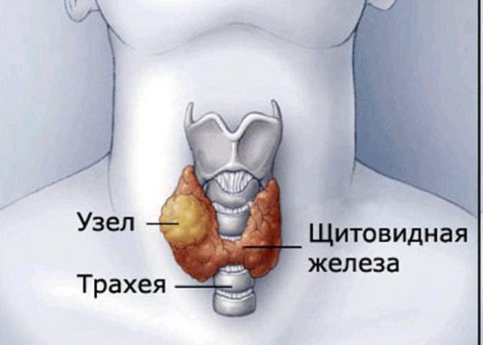 Патологий щитовидной железы