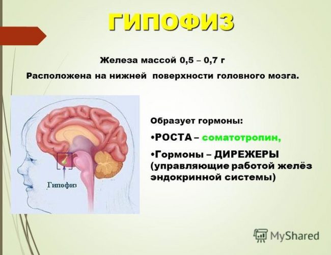 Дисфункция гипофиза головного мозга