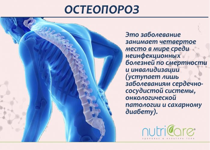 Изображение - Гормоны влияющие на суставы Osteoporoz-1-700x500